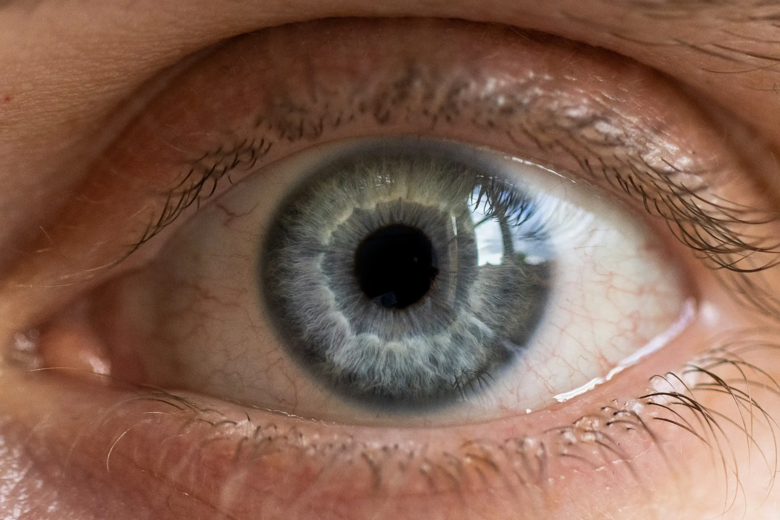 Ocular GvHD Konferenz